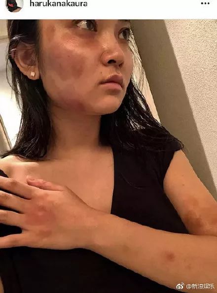 男演员赵骏亚承认家暴事件，公众人物的责任与反思