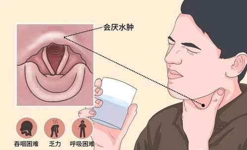 女生喉咙痛从就诊到去世仅10分钟，悲剧背后的医疗警示