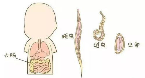 脑干出血后的重生之路——一位程序员的康复之旅