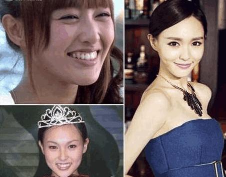 曝光事件，插足他人婚姻女星整容失败